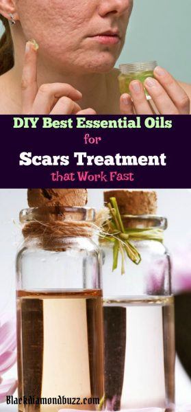 DIY Best Essential Oils for Scars Treatment that Work Fast