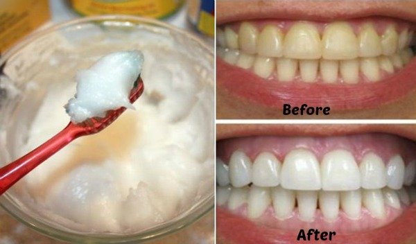 Black Diamond Toothpaste Coupon Black Diamond Toothpaste Coupon