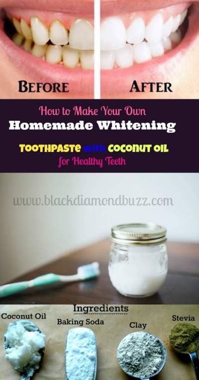 Homemade Toothpaste with Coconut Oil - Health benefits