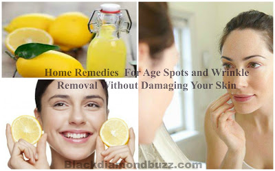 Home Remedies For Age Spots and Wrinkles Removal