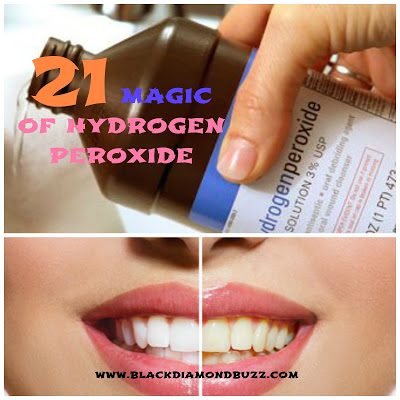21 AMAZING USES OF HYDROGEN PEROXIDE FOR EVERYONE