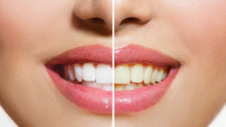 21 AMAZING USES OF HYDROGEN PEROXIDE FOR EVERYONE