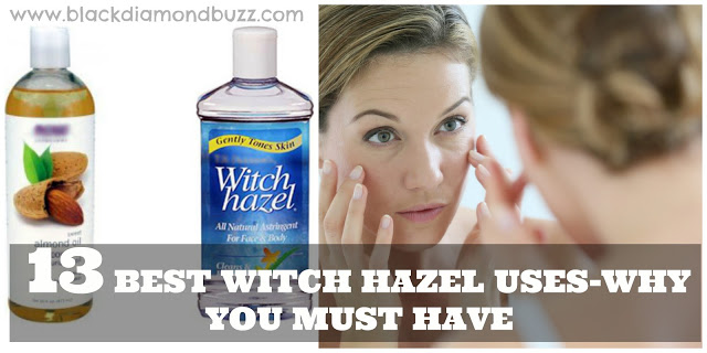 Witch Hazel Uses - Why you must have it