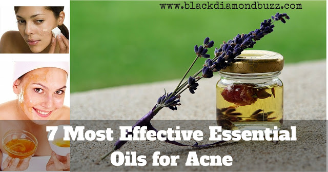  Most Effective Essential Oils for Acne or Pimple