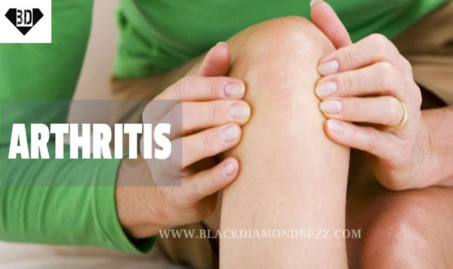 What you should know about Arthritis