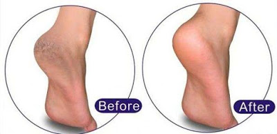 24 Incredible Uses of Epsom Salt at Every home