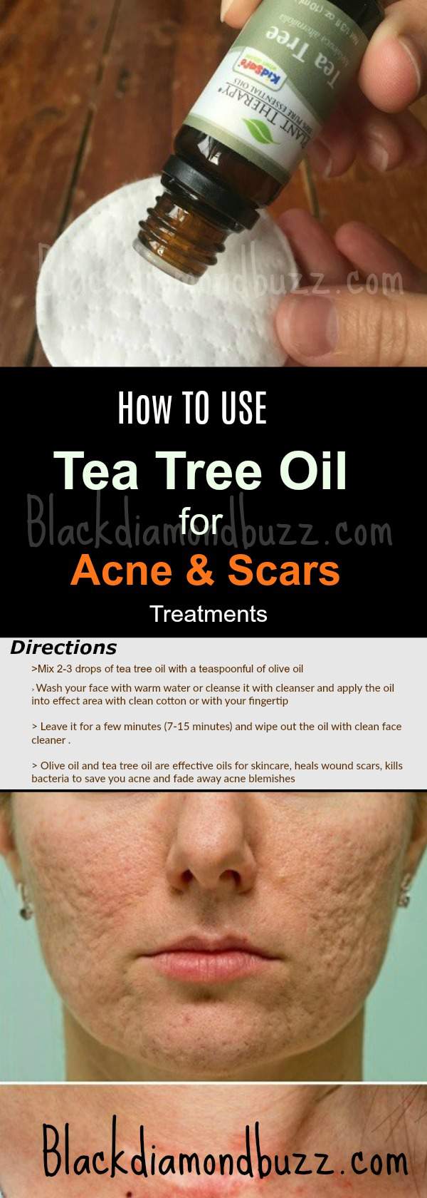 How to use Tea Tree Oil for Acne and Scars Treatments