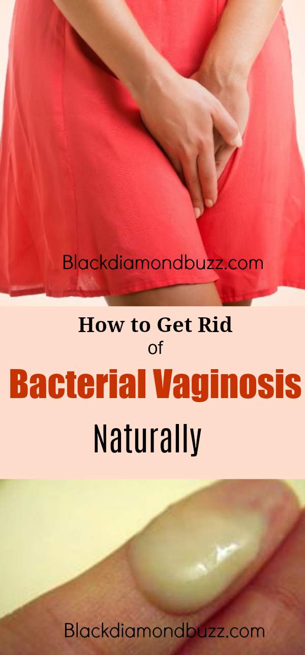 How to Get Rid of Bacterial Vaginosis. These treatments willl cure BV and it will make your vaginal odor go away. The 3 active ingredients are Coconut oil,ACV and Essential oils