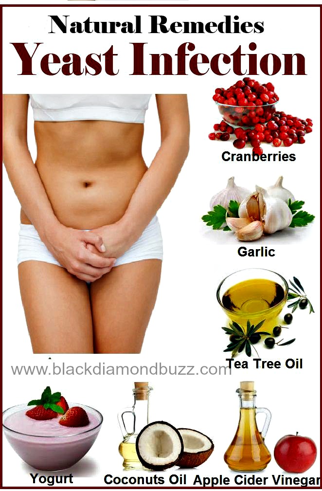 Yeast Infection Home Remedies for Instant Cure