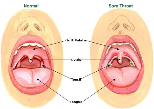 Top 7 Essential Oil for Sore Throat that Work Fast