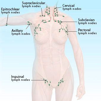 Instant Remedies for Swollen Lymph Nodes