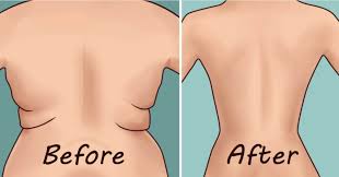 7 Best Exercises to Get Rid Of Back Fat At Home