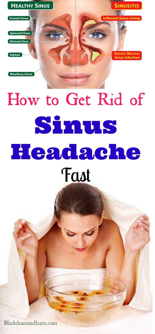 7 Home Remedies for Sinus Headache Fast Relief