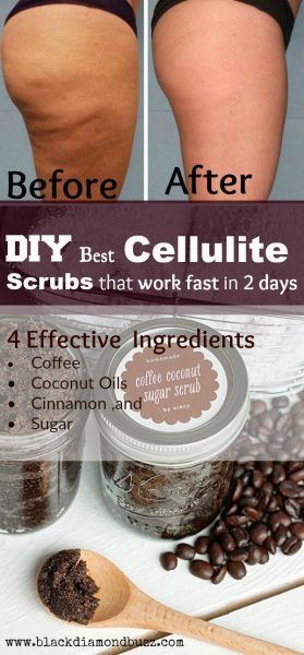 How to Get Rid of Cellulite on Back of Thighs and Bum Fast