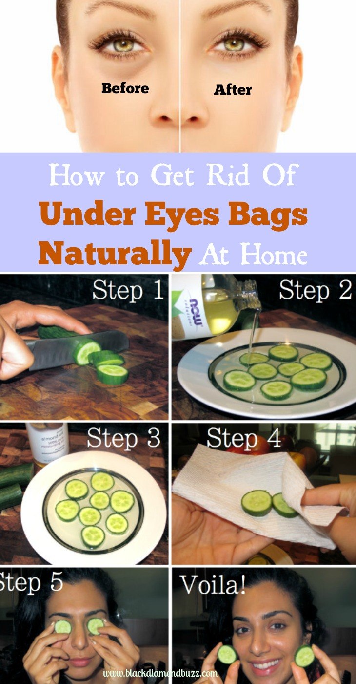 How to Get Rid Of Under Eyes Bags Naturally At Home