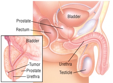 Prostate Specific Antigen: PSA Levels and What They Mean