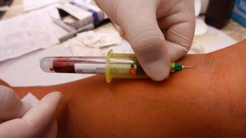 Prostate Specific Antigen: PSA Levels and What They Mean