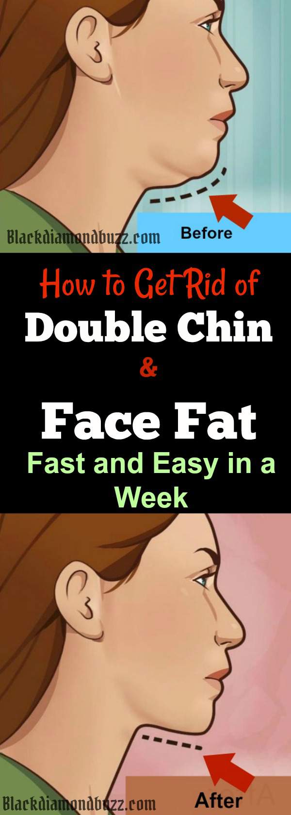 How to Get Rid of Double Chin and Face Fat Fast and Easy in a Week