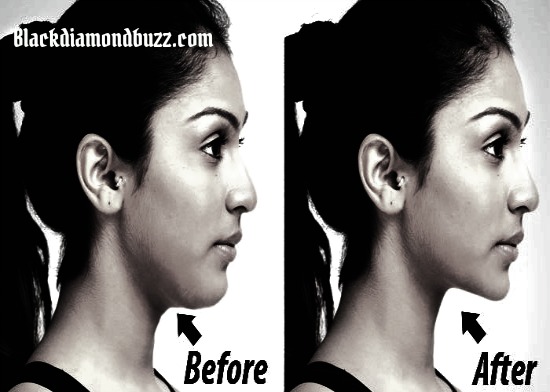 How to Get Rid of Double Chin and Face Fat Fast and Easy in a Week