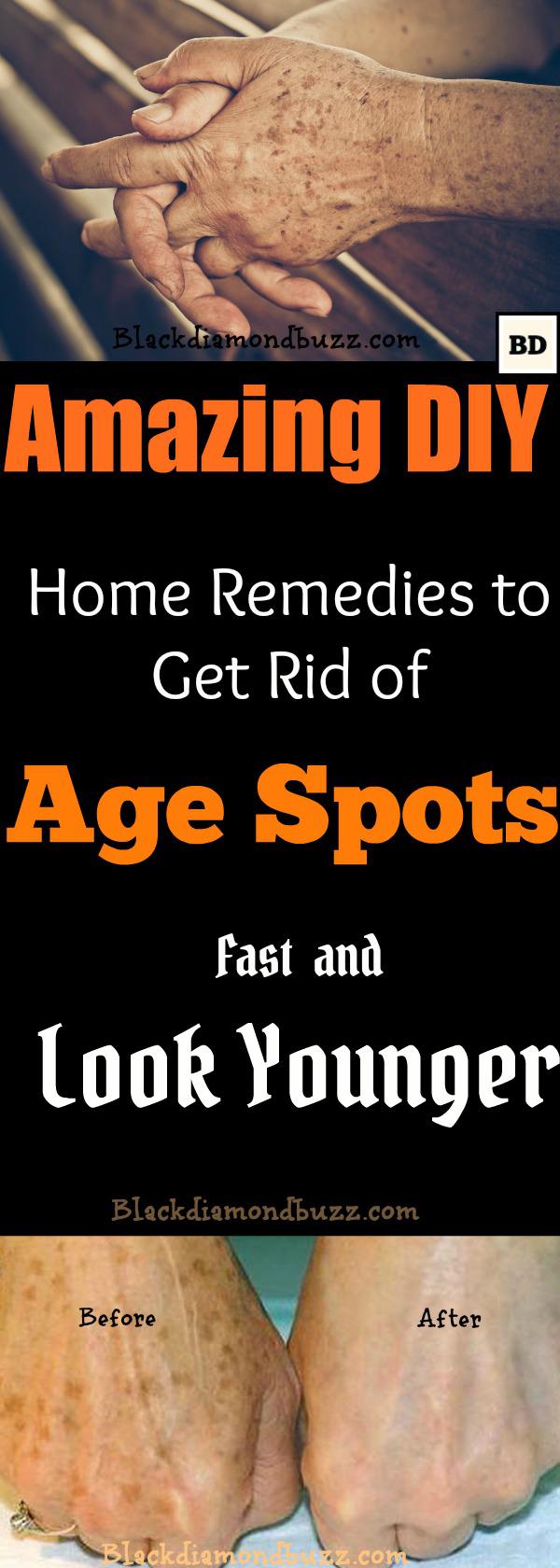 How to Get Rid of Age Spots on Face | 7 Home Remedies That Work Fast