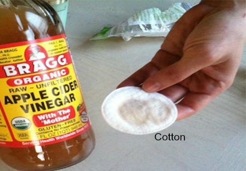 How to get rid of blackheads fast – 10 best home remedies