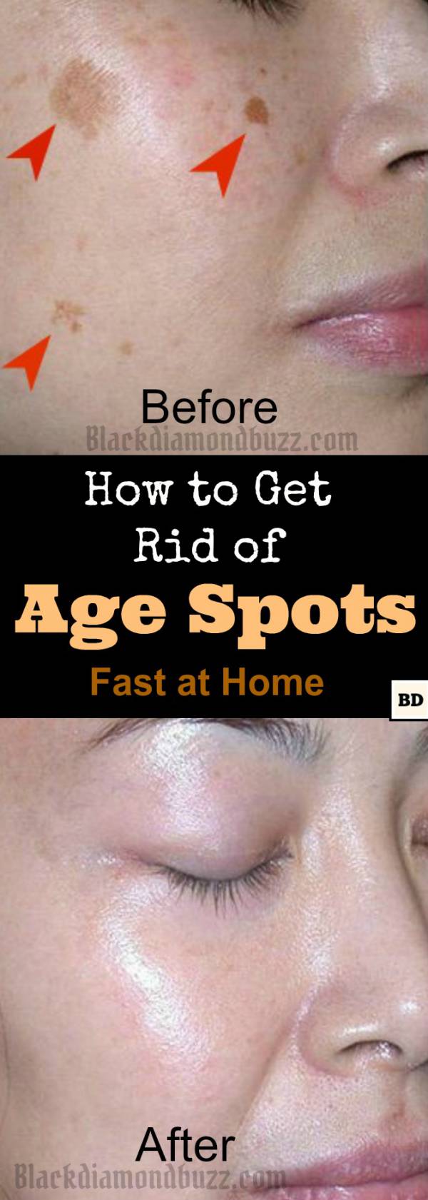 How to Get Rid of Age Spots on Face | 7 Home Remedies That Work Fast