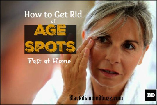 how to get rid of age spots fast at home__ Home remedies for dark age spots removal