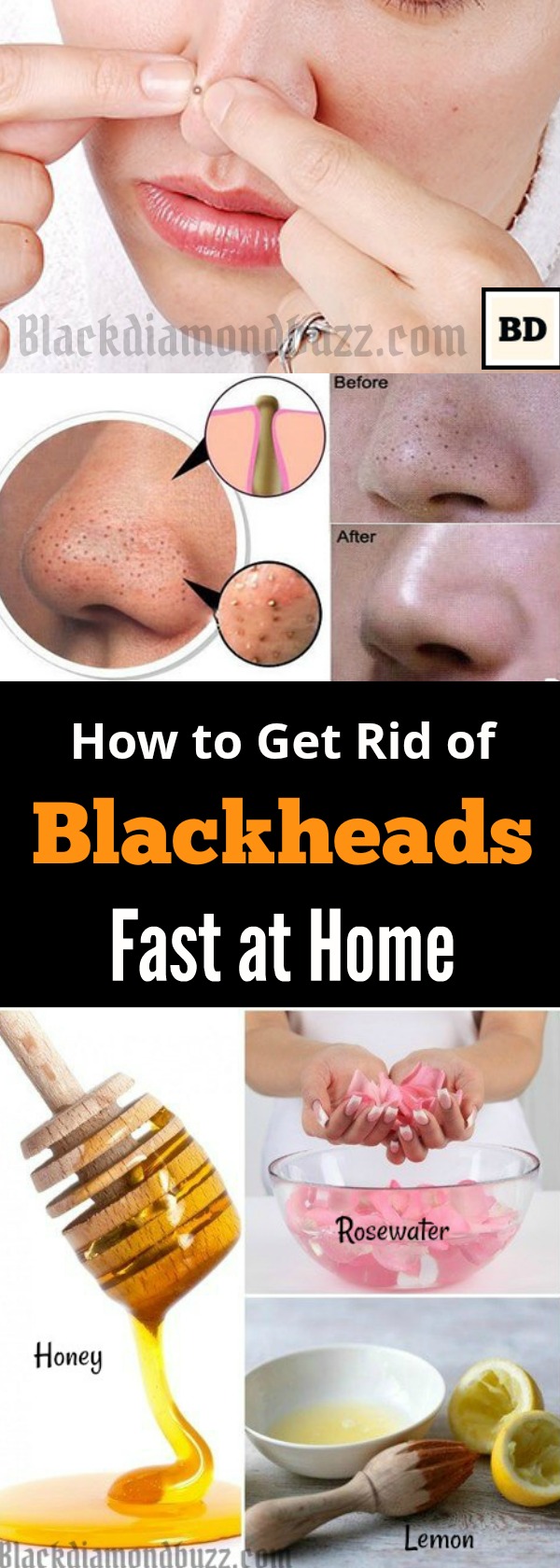 how to get rid of blackheads fast at home