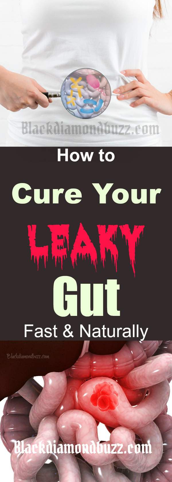 How to Heal Leaky Gut Naturally - Leaky Gut Cure Diet