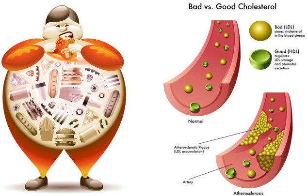 How to Lower Cholesterol Naturally in 2 Days