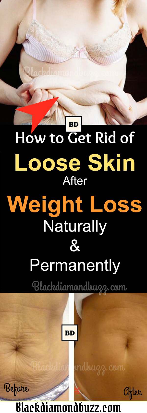 How to Get Rid of Loose Skin after Weight Loss Naturally and Permanently