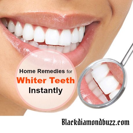 How to Get Rid of  Yellow Teeth Fast! 9 Best Home Remedies for Whiter Teeth 