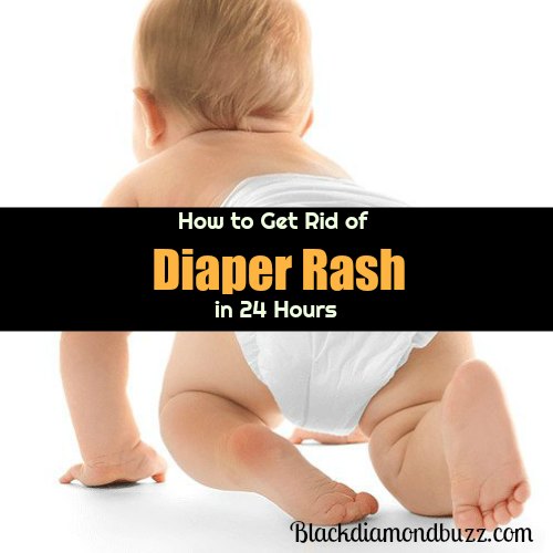 Home Remedies for Diaper Rash: Treatments to Get Rid of Diaper Rash In 24 Hours