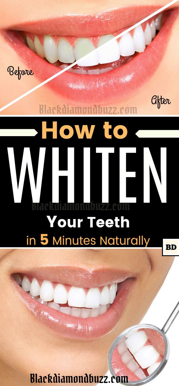 How to Get Rid of  Yellow Teeth Fast! 9 Best Home Remedies for Whiter Teeth 