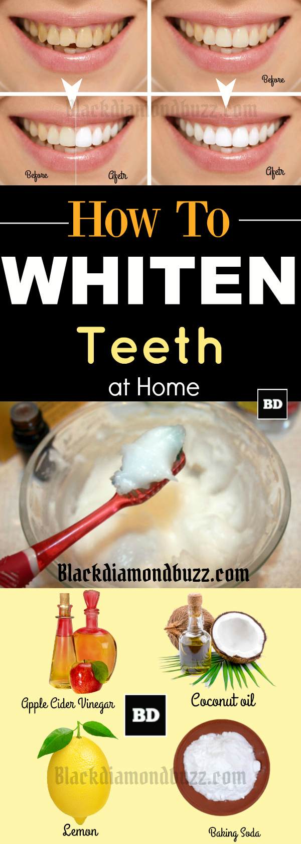 Home Remedies for Whiter Teeth 