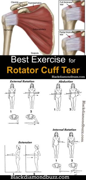 Best Exercise for Rotator Cuff Injury and Strengthening