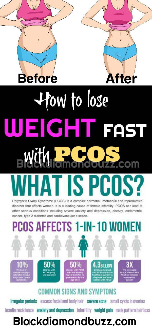 How to Lose Weight with PCOS and Insulin Resistance Naturally