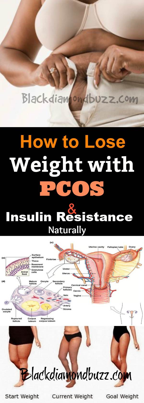 How to Lose Weight with PCOS and Insulin Resistance Naturally