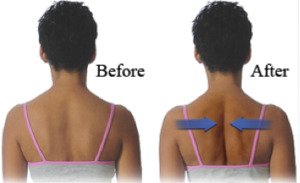 Herniated Disc Exercises for Fast Result for Lower Back Pain